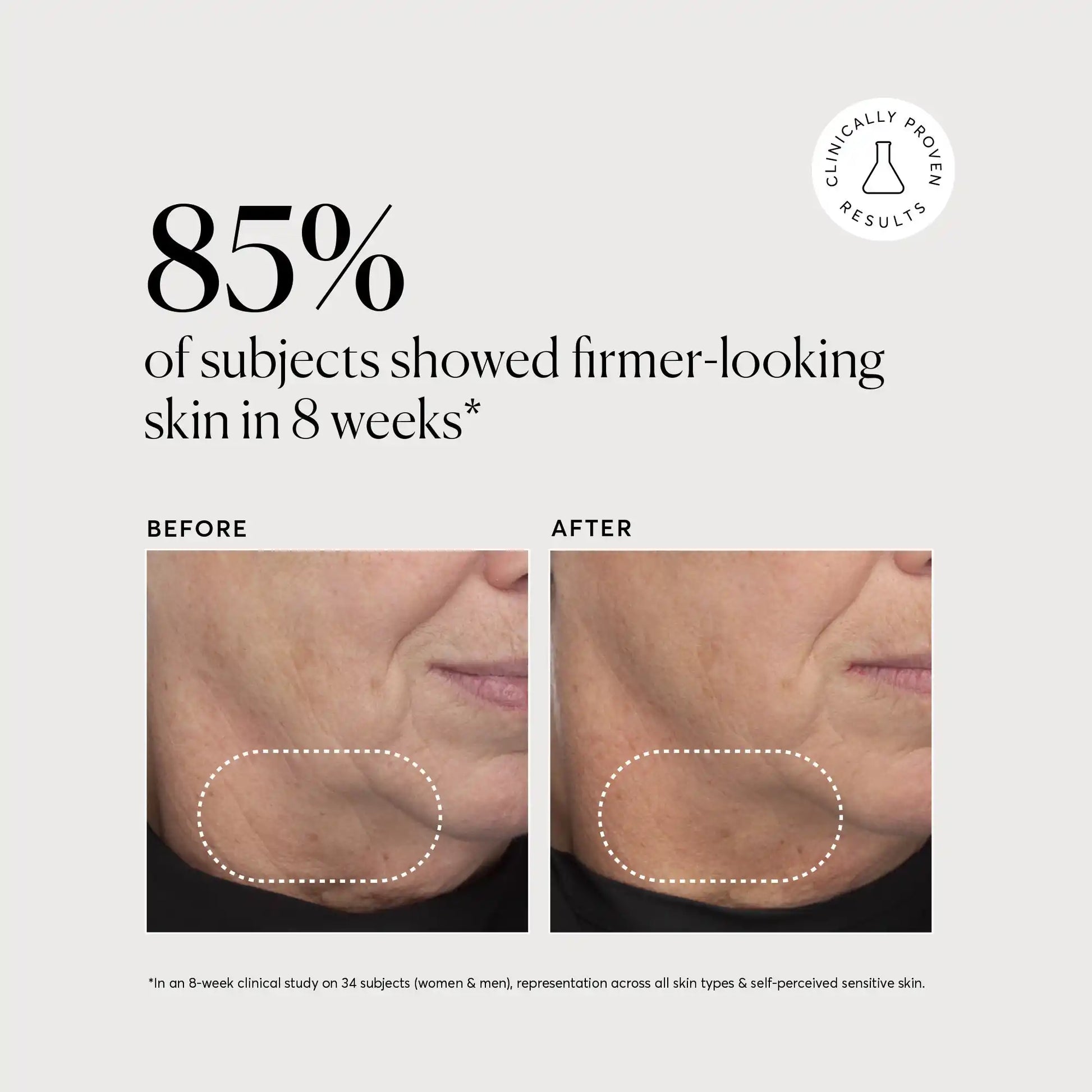 retinol-complex-serum-l7 NATR-10034-Alt-Images-Retinol-Complex-Serum-04.webp
